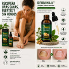 NOSTLIGHT - TRATAMIENTO ANTI HONGOS 7 DÍAS 100% NATURAL