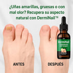 NOSTLIGHT - TRATAMIENTO ANTI HONGOS 7 DÍAS 100% NATURAL